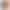 Apple Watch Series 11