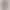 Apple Watch Series 11 GPS, Cassa 46 mm in Alluminio Oro Rosa